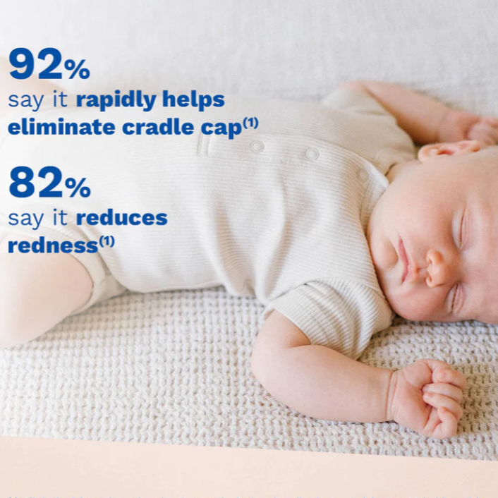 Cradle Cap Cream - Na